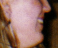 Unidentified Person 3241