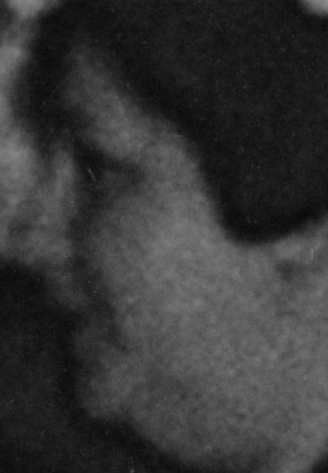 Unidentified Person 4025